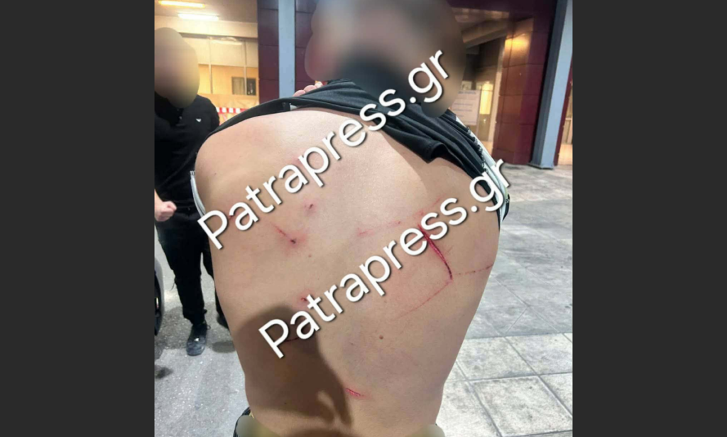 Δυτ. Ελλάδα: Χτύπησαν 18χρονο με κατσαβίδι 13 φορές και πήγαν να τον πετάξουν στη θάλασσα - Εικόνα